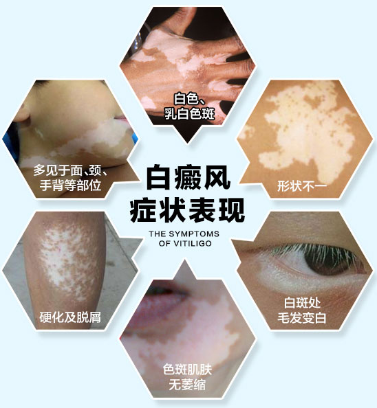 QQ截图20180119095633.png